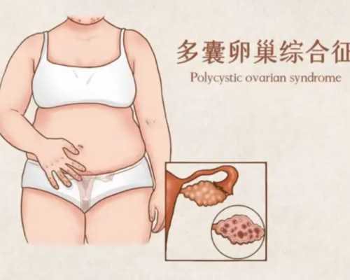 天津三代试管生男孩多少钱？附详细费用流程？