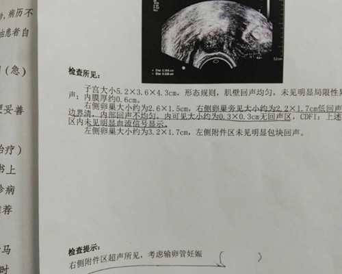 北京医院供卵流程,北京家圆医院试管收费,北京朝阳医院做试管怎么样